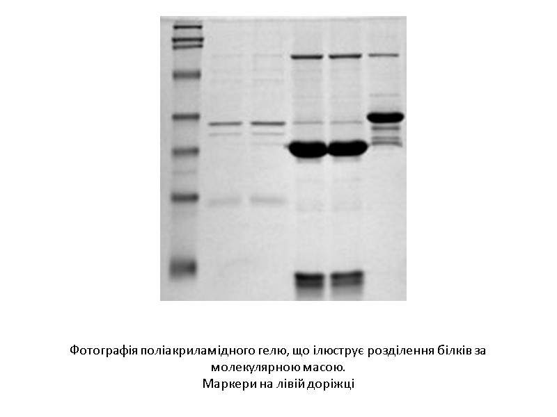 Фотографія поліакриламідного гелю, що ілюструє розділення білків за молекулярною масою. Маркери на лівій доріжці